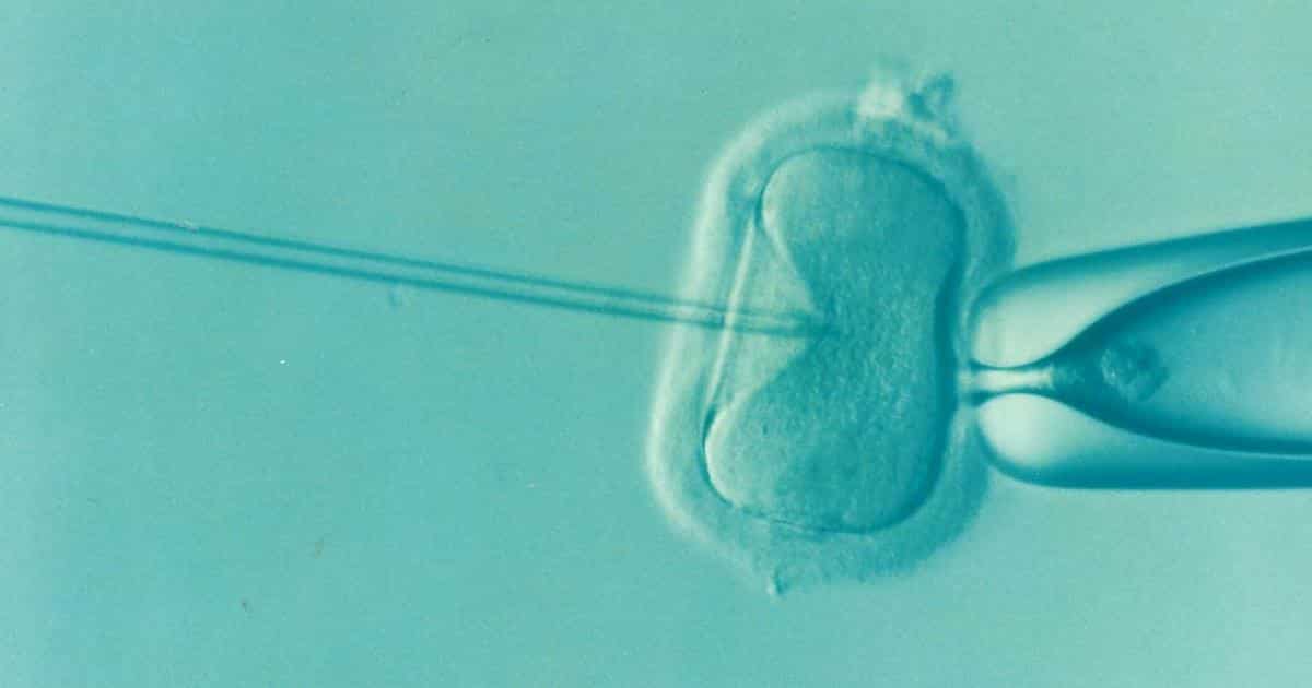 Artificial insemination may increase the risk of mental disabilities