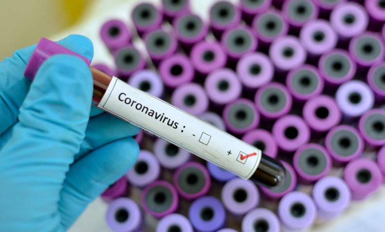 Qatar reports first death from coronavirus; 28 new cases Qatar reports first death from coronavirus; 28 new cases