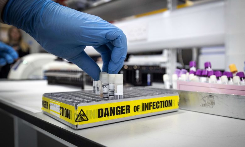 Australian researchers test a drug that kills coronavirus within 48 hours Australian researchers test a drug that kills coronavirus within 48 hours
