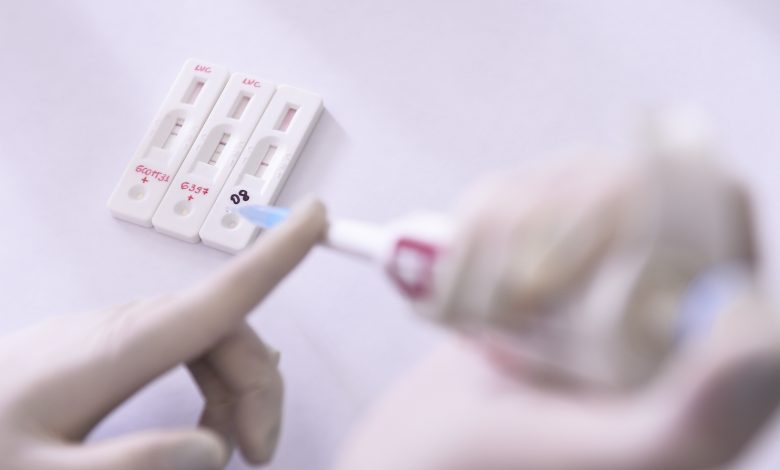 New test to diagnose Covid-19 in just 20 minutes New test to diagnose Covid-19 in just 20 minutes